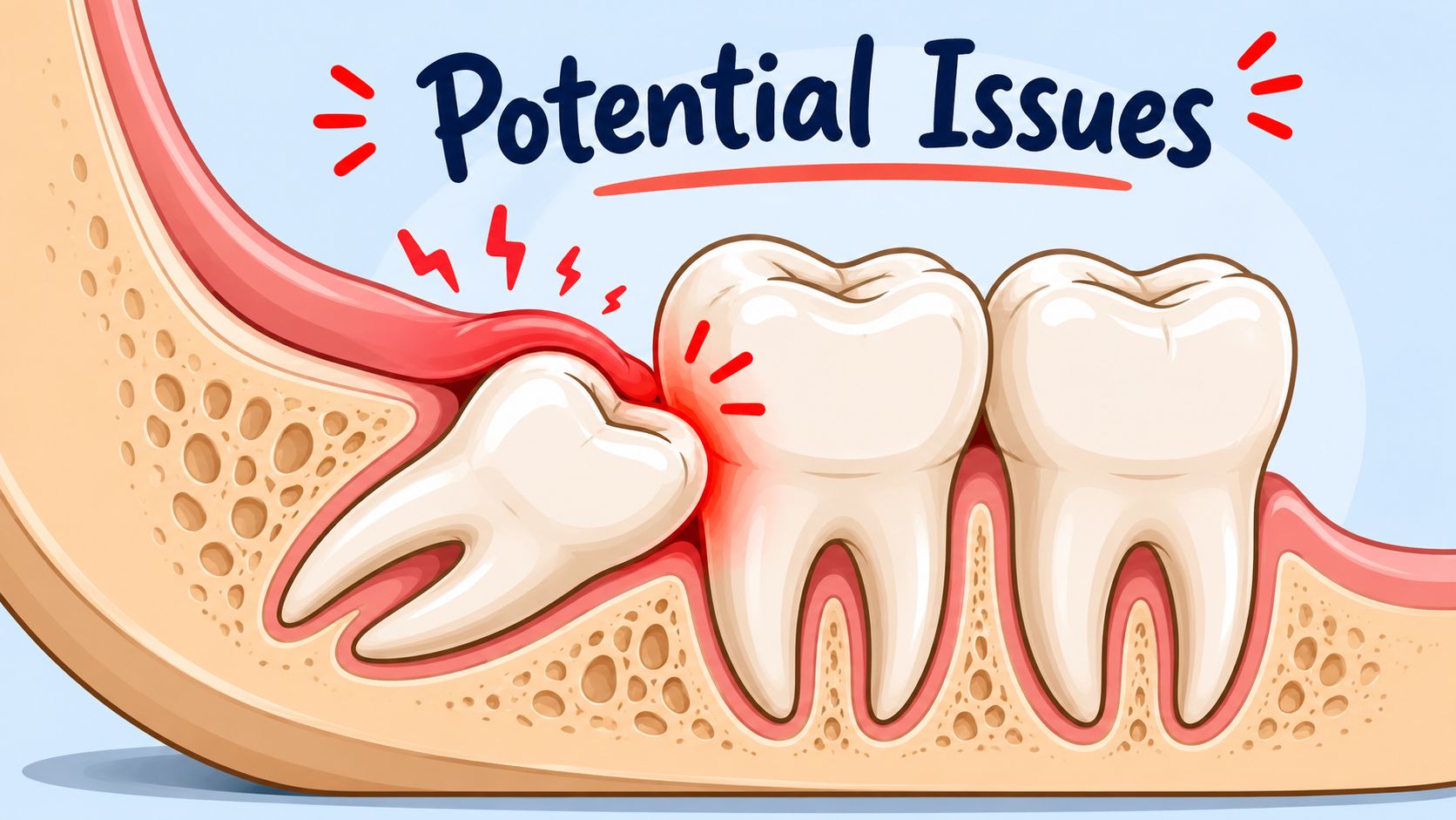 Potential Problems Wisdom Teeth Can Cause