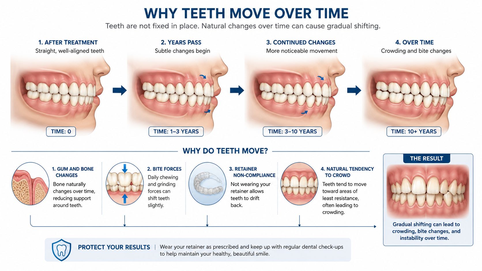 An infographic showing how teeth gradually shift and become crowded over time after orthodontic treatment concludes.