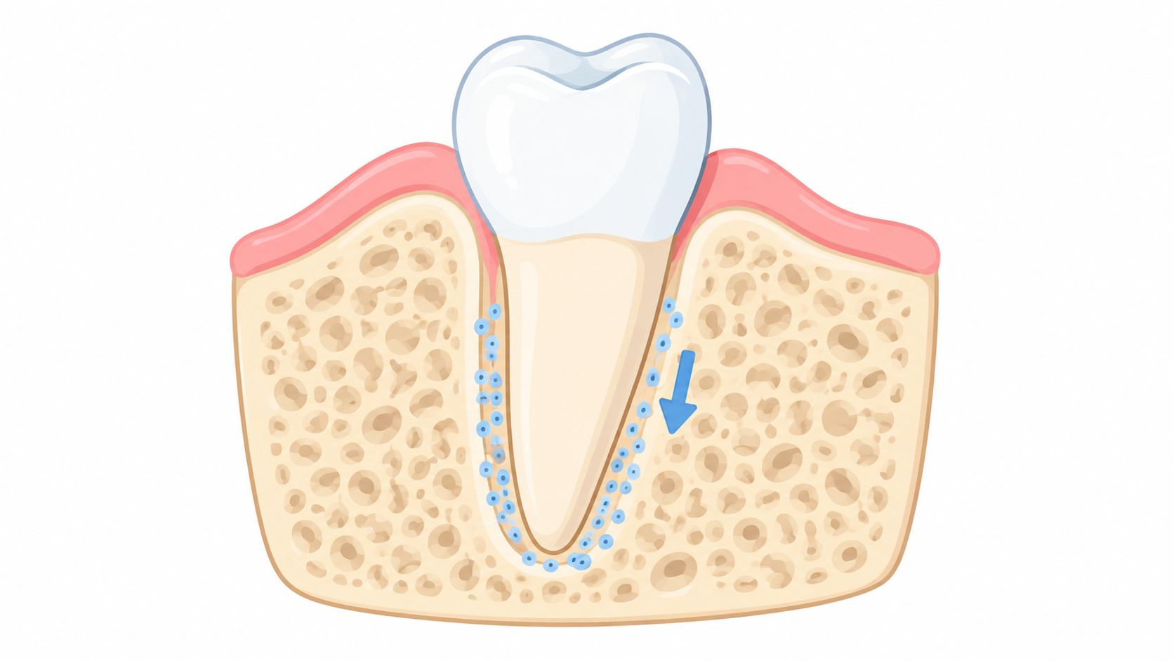 A diagram illustrating the movement of a tooth through bone tissue, representing the concept of orthodontic treatment.